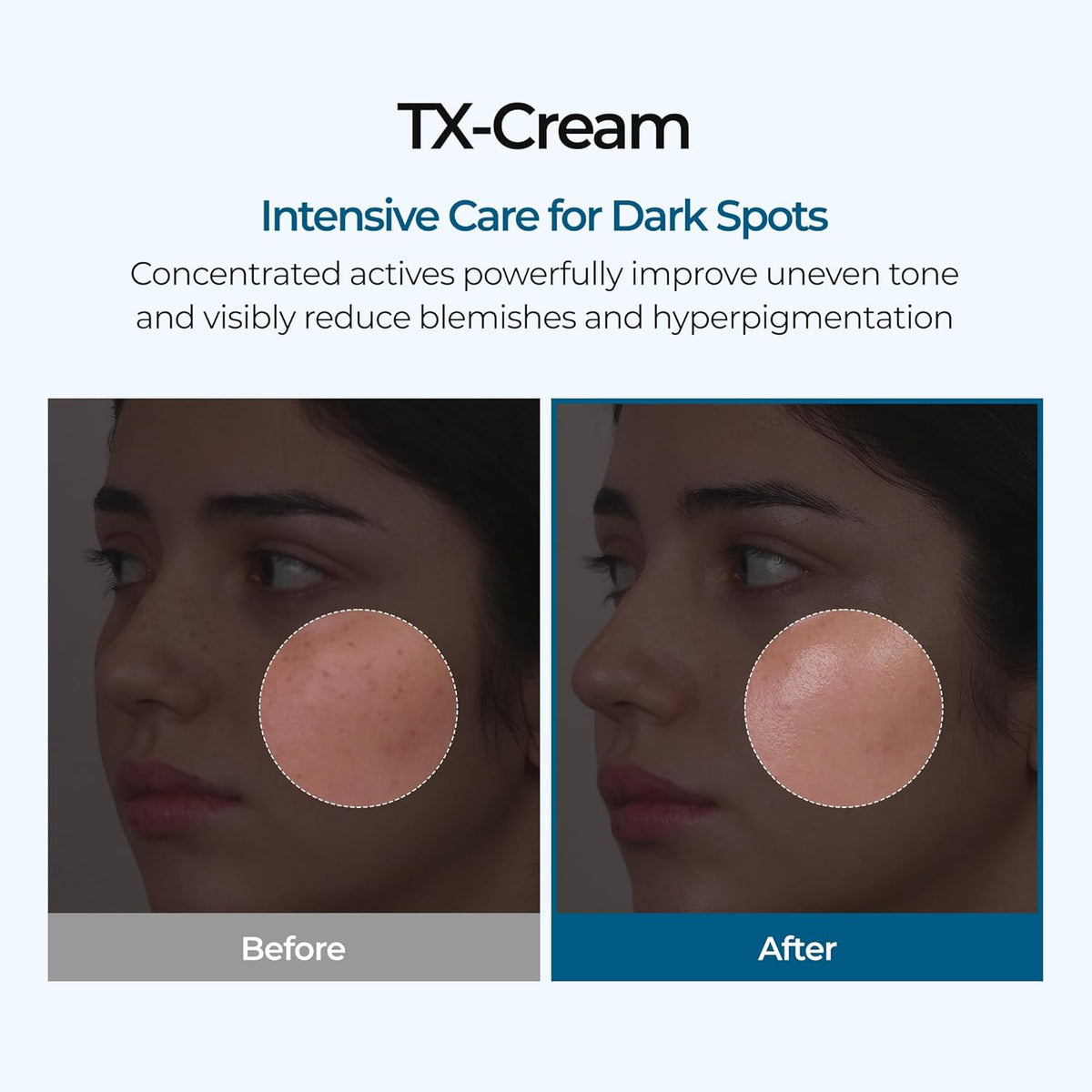 DR.Melaxin TX Tranexamic Acid CREAM | Korean Cosmetics | 1.7 fl oz (50 ml)