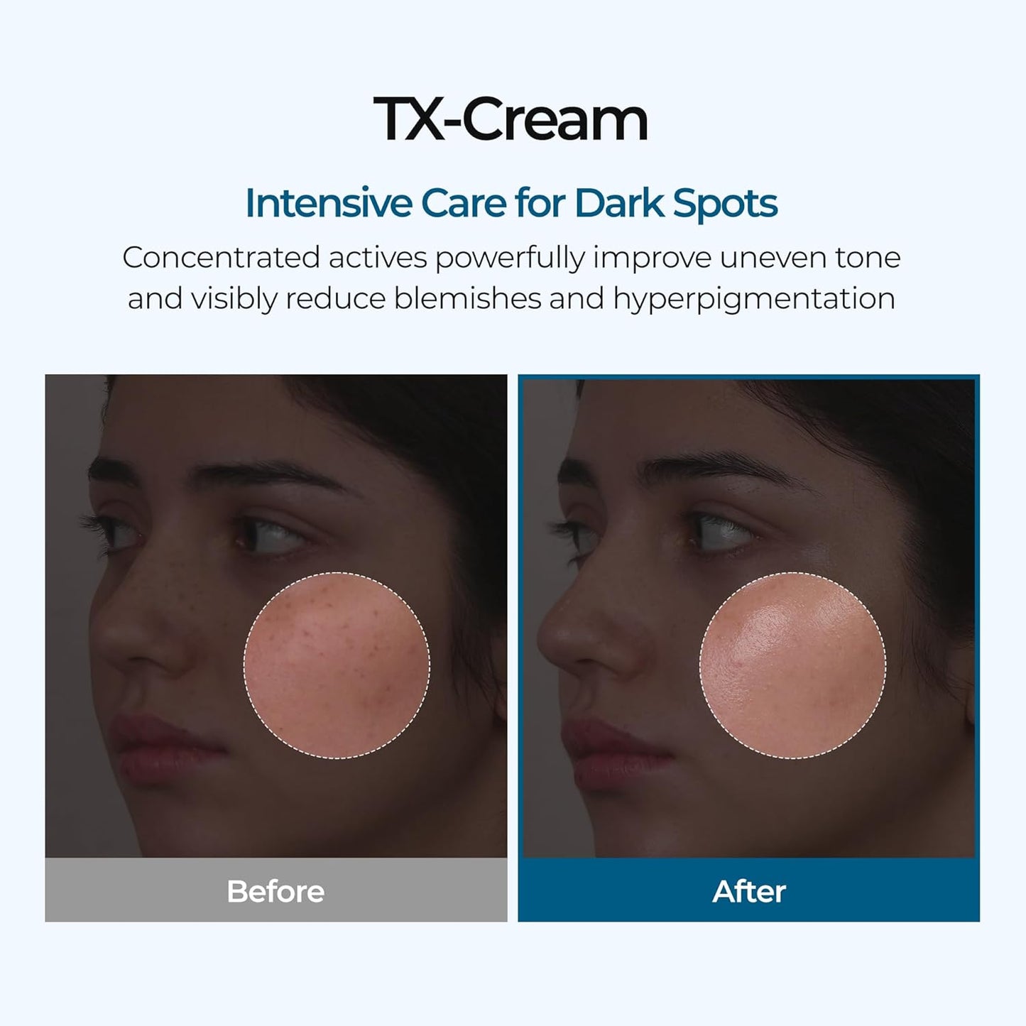 DR.Melaxin TX Tranexamic Acid CREAM | Korean Cosmetics | 1.7 fl oz (50 ml)