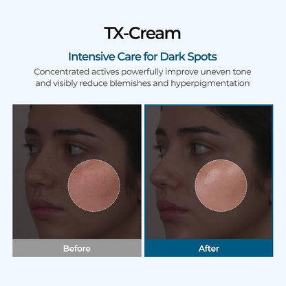 DR.Melaxin TX Tranexamic Acid CREAM | Korean Cosmetics | 1.7 fl oz (50 ml)